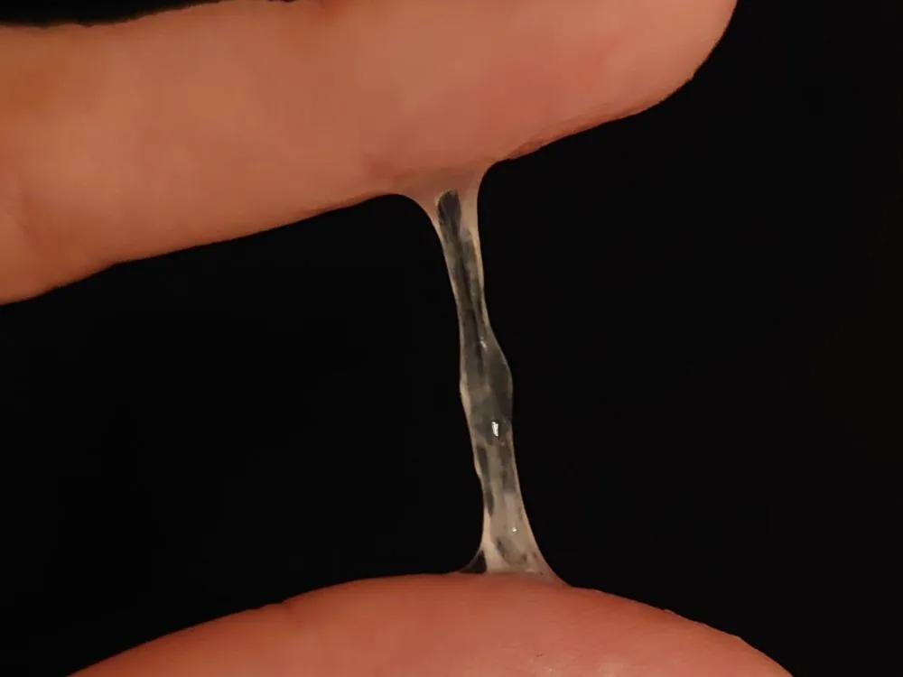 Moco cervical S+ transparente y elástico, con vetas blanquecinas, en el día 14 del ciclo