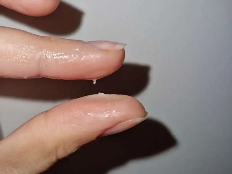 Moco cervical de color blanquecino y cremoso en el día 16 del ciclo (2), tras 6 días de S+, anticoncepción con trackle
