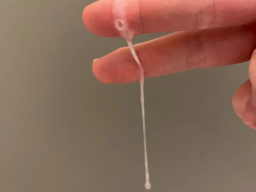 Mucosidad cervical líquida en el día 9 del ciclo (S+), anticoncepción natural con trackle